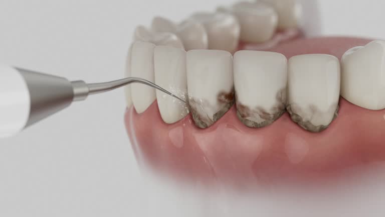 Reliable Emergency Dentist contractor in Halfway, MD by Smile Center Dentistry
